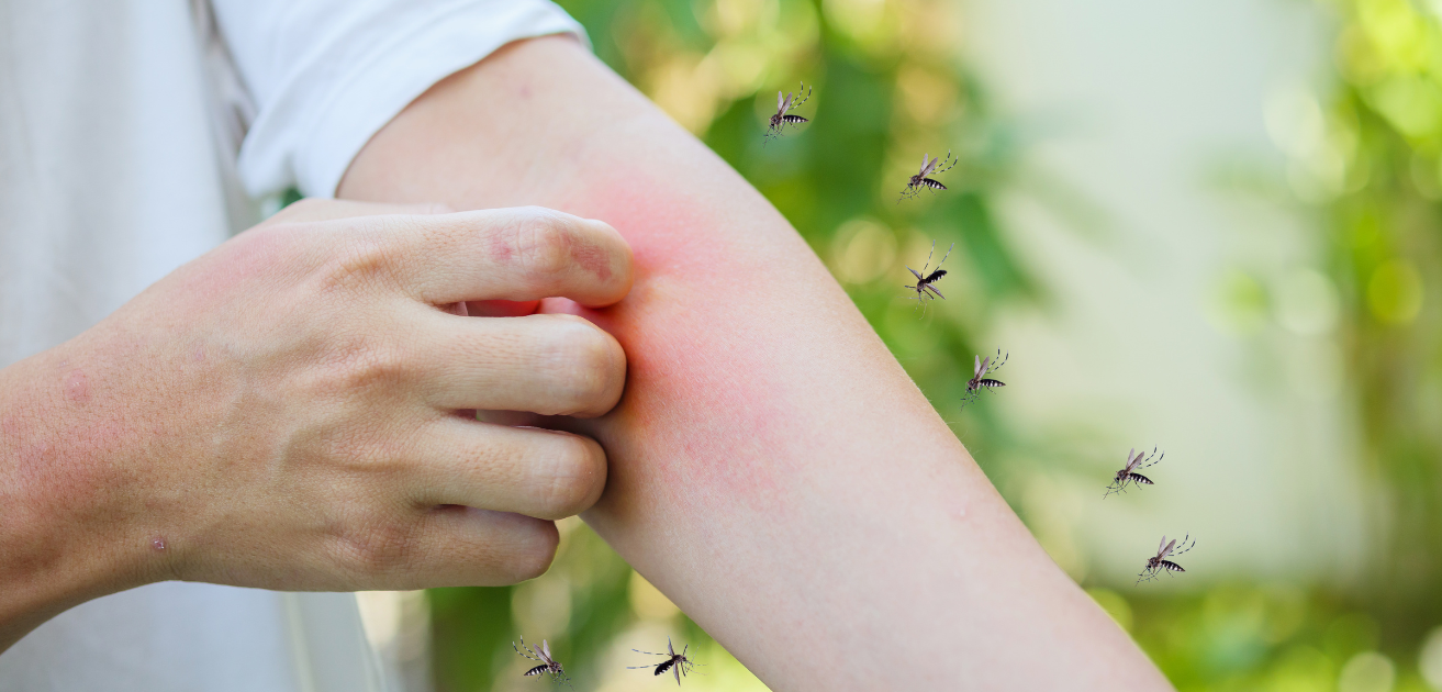 Come difendersi dalle zanzare in modo naturale