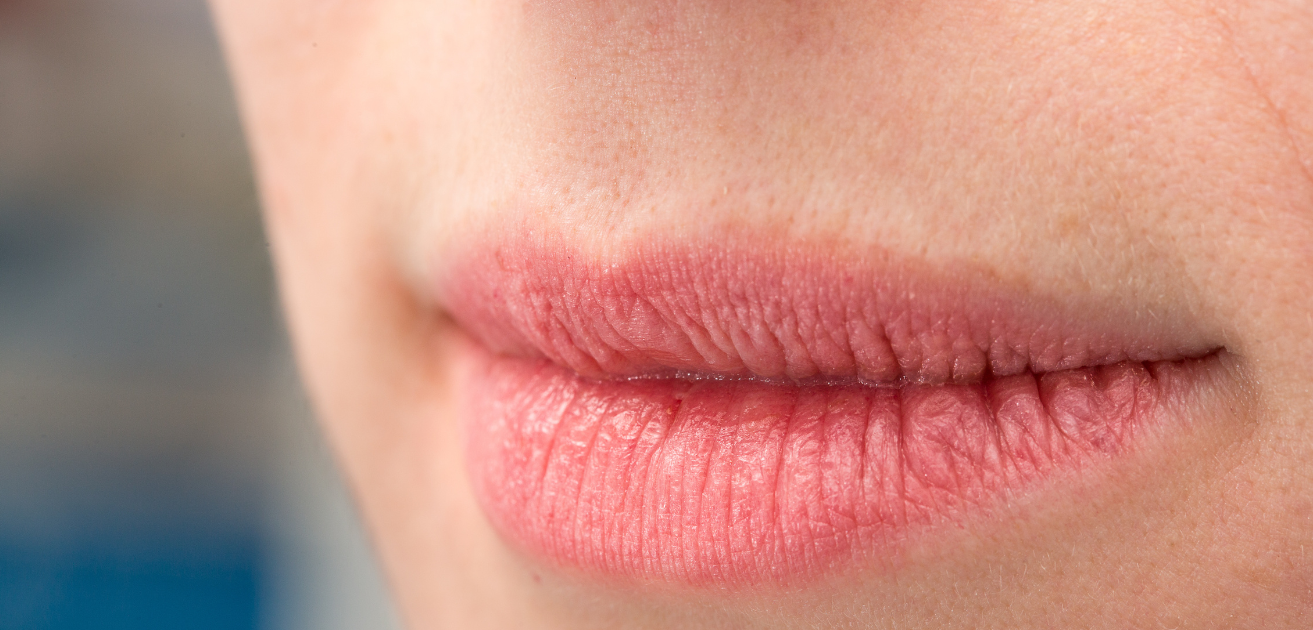 Ragadi labbra: come trattarle e quali prodotti preferire